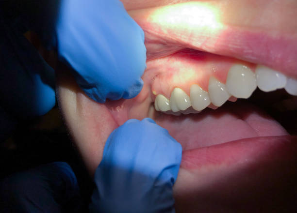 Best Mobile Emergency Dentist in Highland, AR